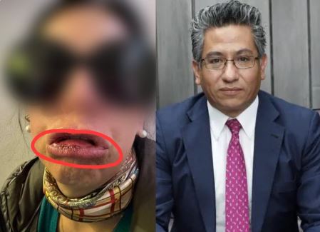 Exdiputado solicita la destitución del gerente de EMAPA por denuncias de violencia