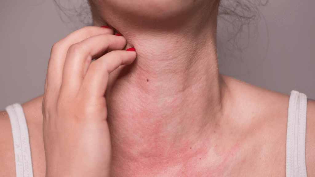 Identifique sus alergias a tiempo para mejorar su salud