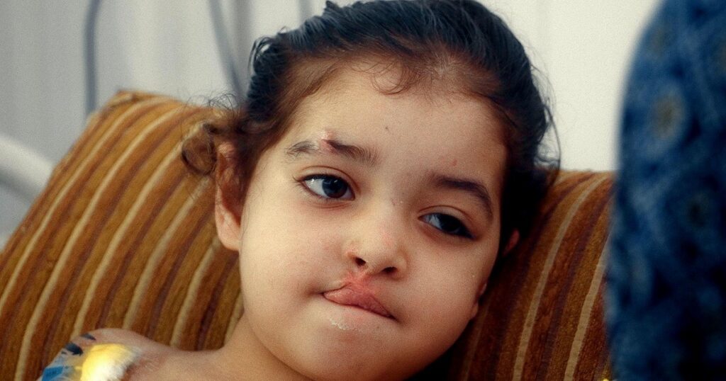 Situación crítica en Gaza: niños heridos y riesgo de infecciones resistentes